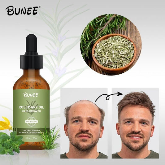 BUNEE Rosemary Hair Growth Serum Oil 30 ML(Pack of 2)