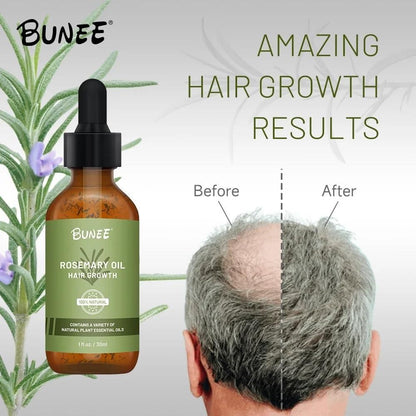 BUNEE Rosemary Hair Growth Serum Oil 30 ML(Pack of 2)